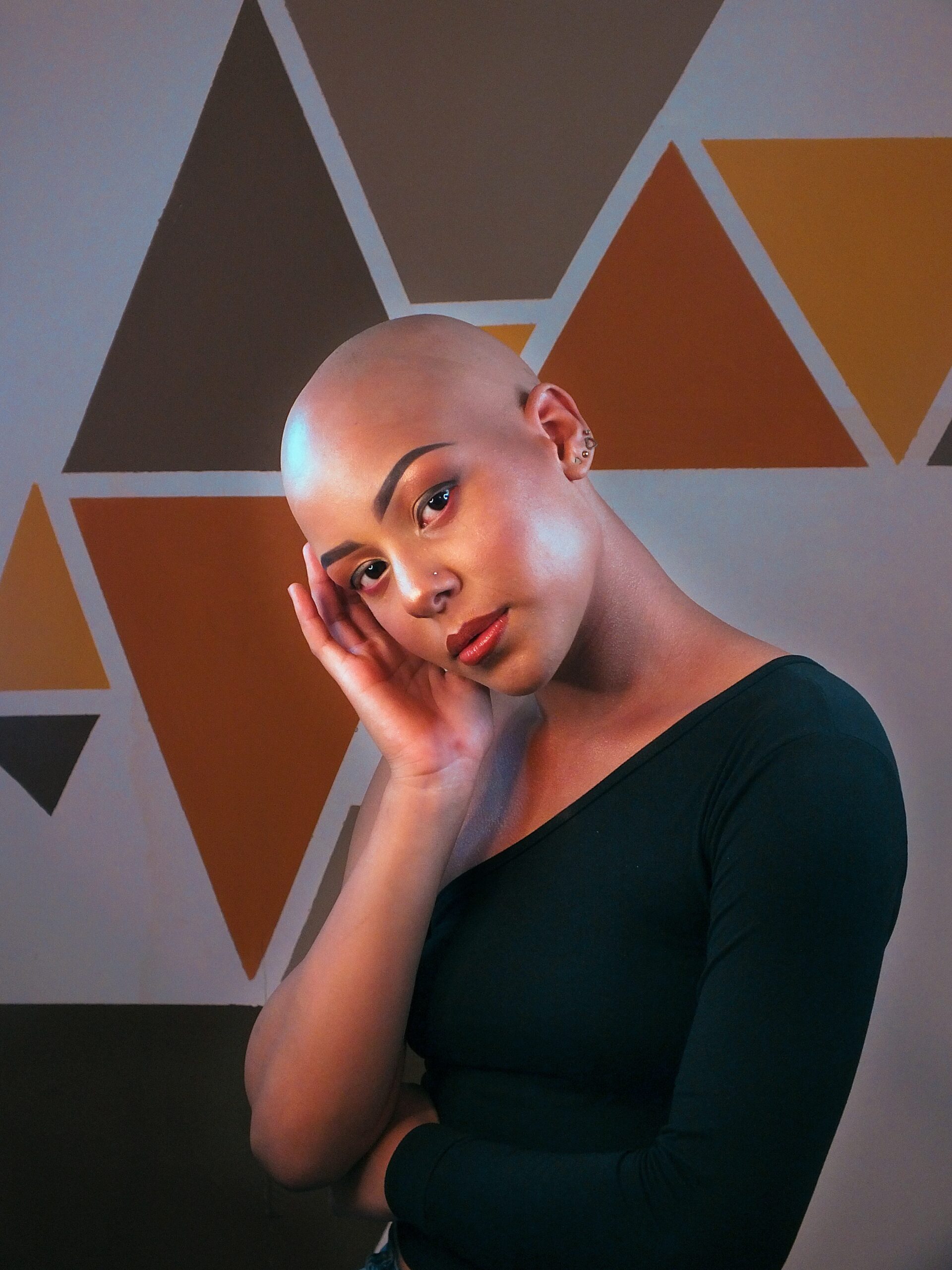 You are currently viewing 14 Things You Didn’t Know About Alopecia
